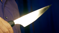 The Amazing Johnathan’s Knife Through Arm
